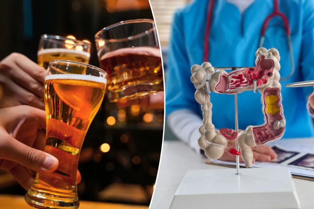 Doctors warn of "large and related to the increase" of alcohol -related cancer deaths in the United States, which have been affected by the worst